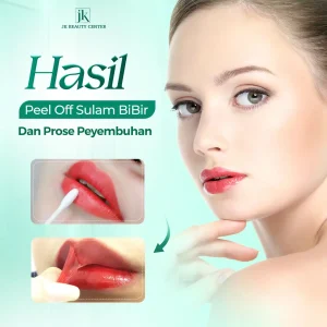 Hasil Peel Off Sulam Bibir Dan Proses Peyembuhan