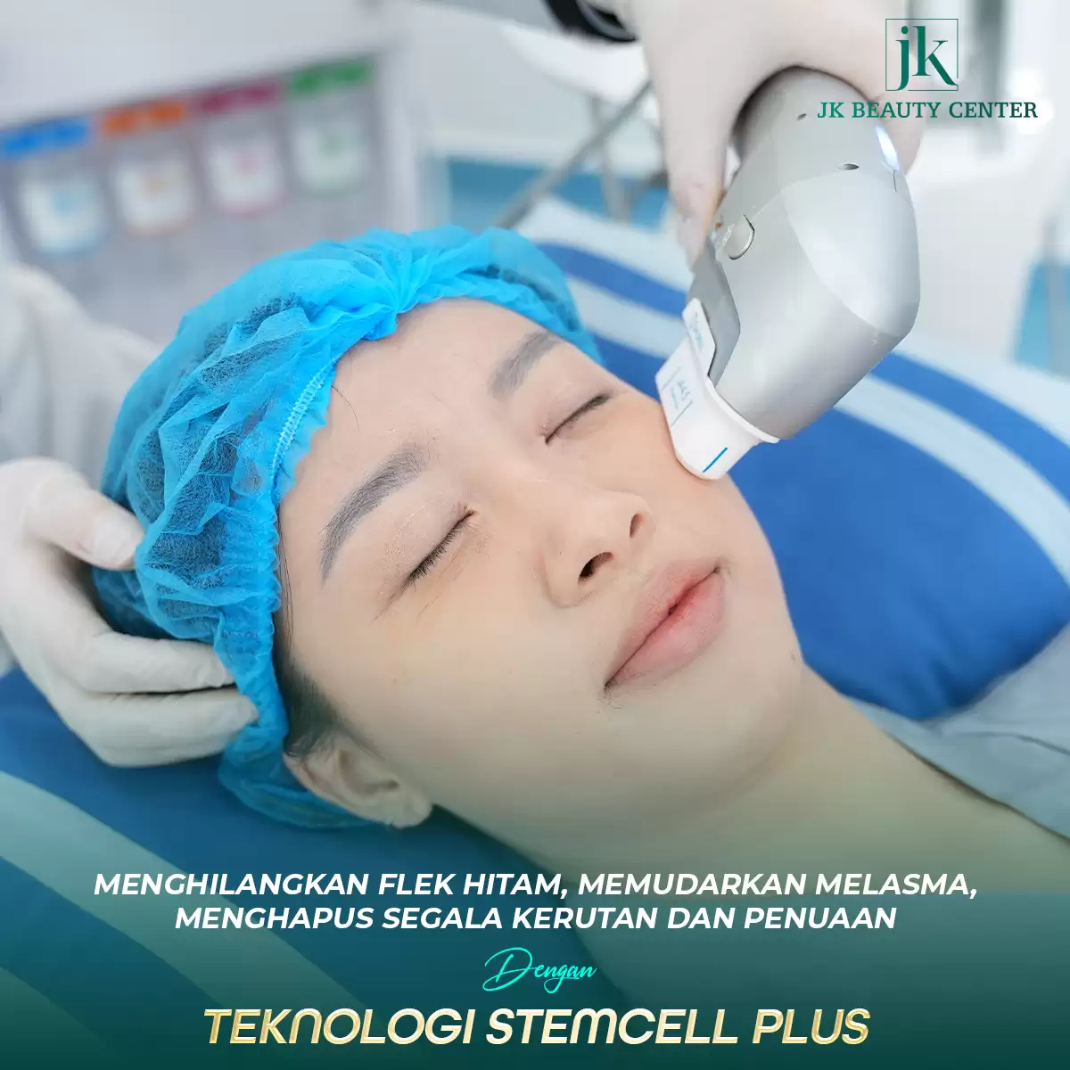 Dokter menggunakan teknologi Stemcell Plus Hifu untuk hilangkan kerutan di wajah
