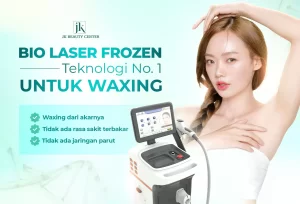 Bio Laser Frozen – Teknologi hair removal terbaru saat ini