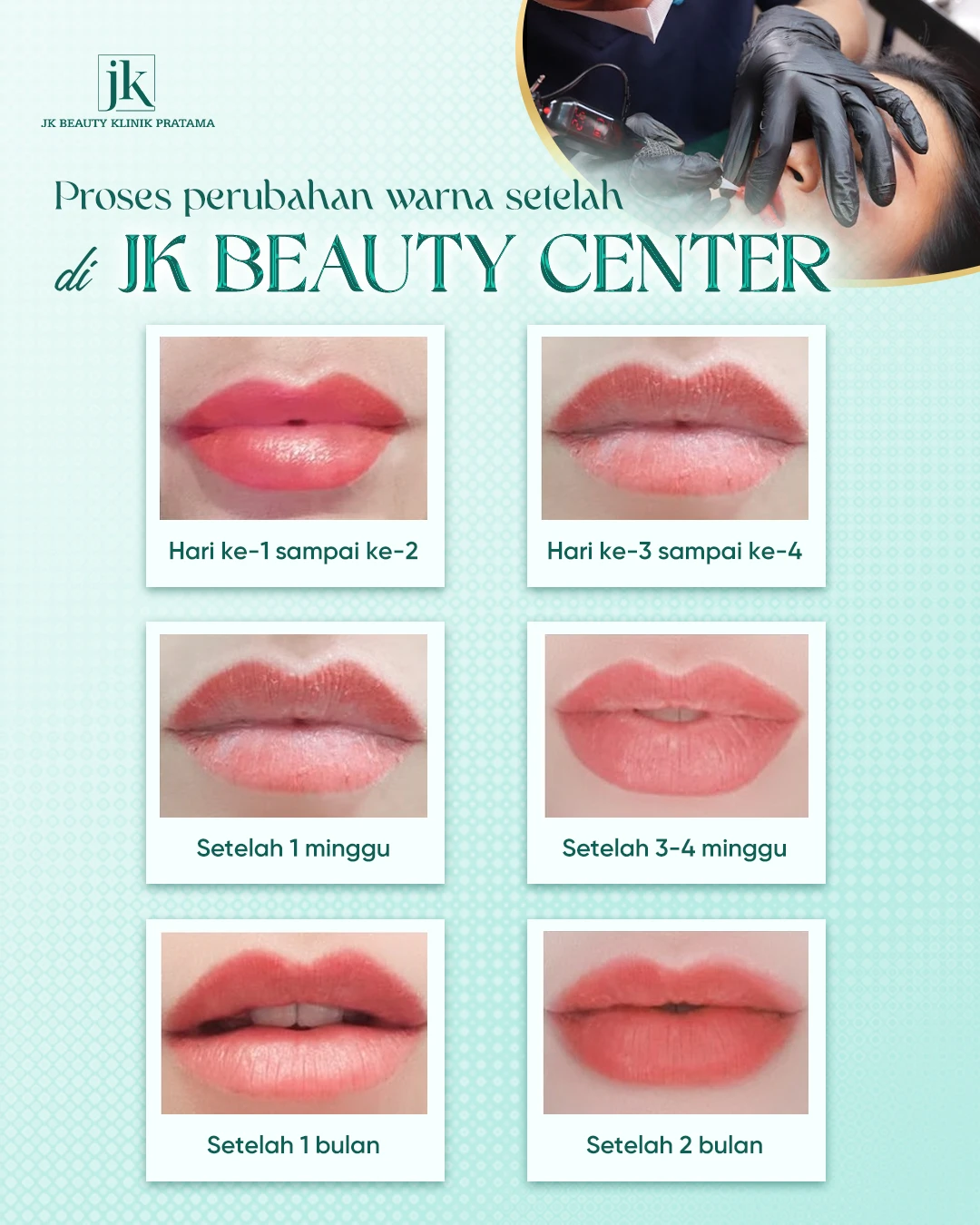 Perawatan pasca-sulam bibir: Petunjuk selama 7 hari pertama agar bibir terkelupas indah dan mendapatkan warna yang diinginkan