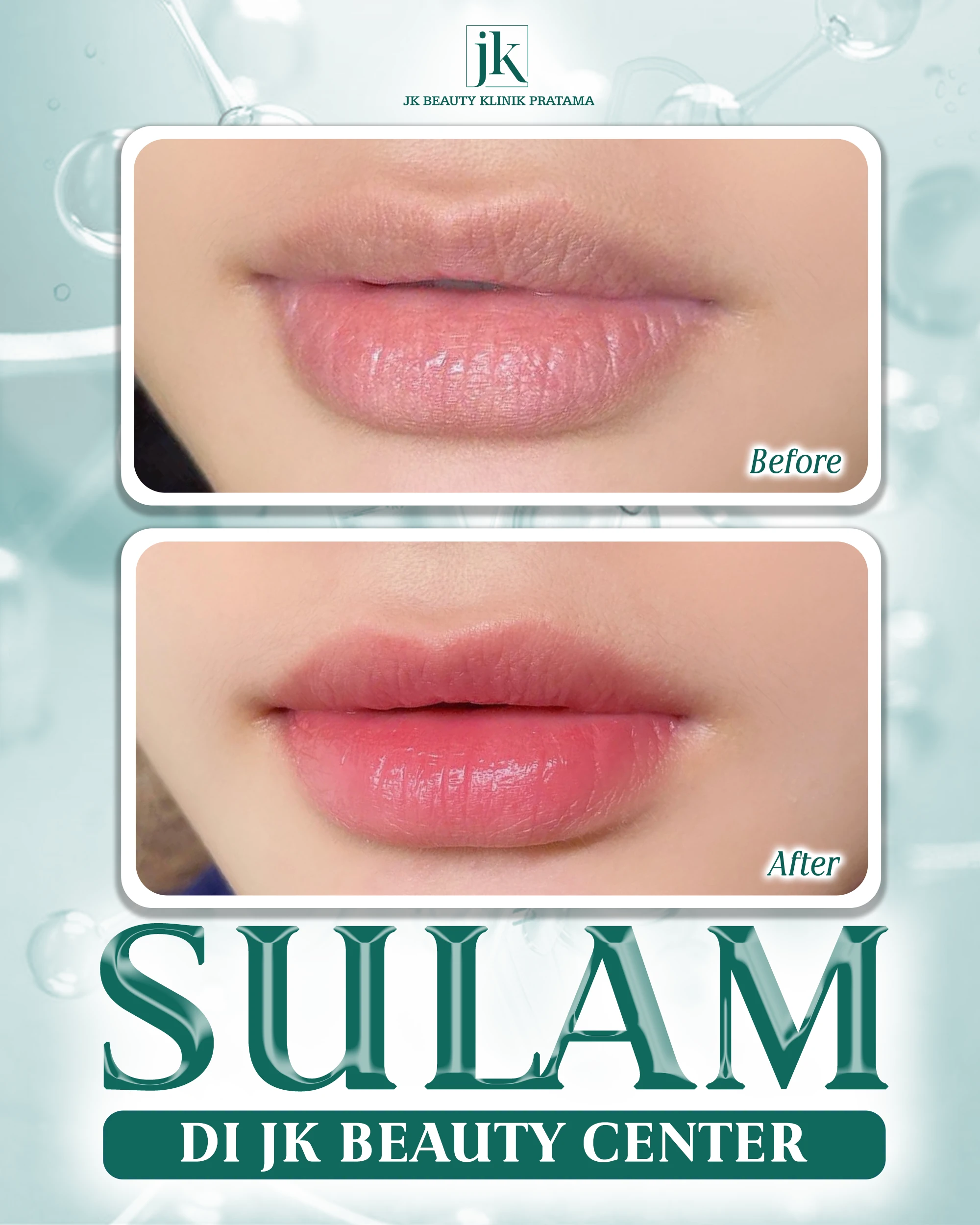 Sulam ombre warna nude – Tren tato bibir natural di tahun 2025