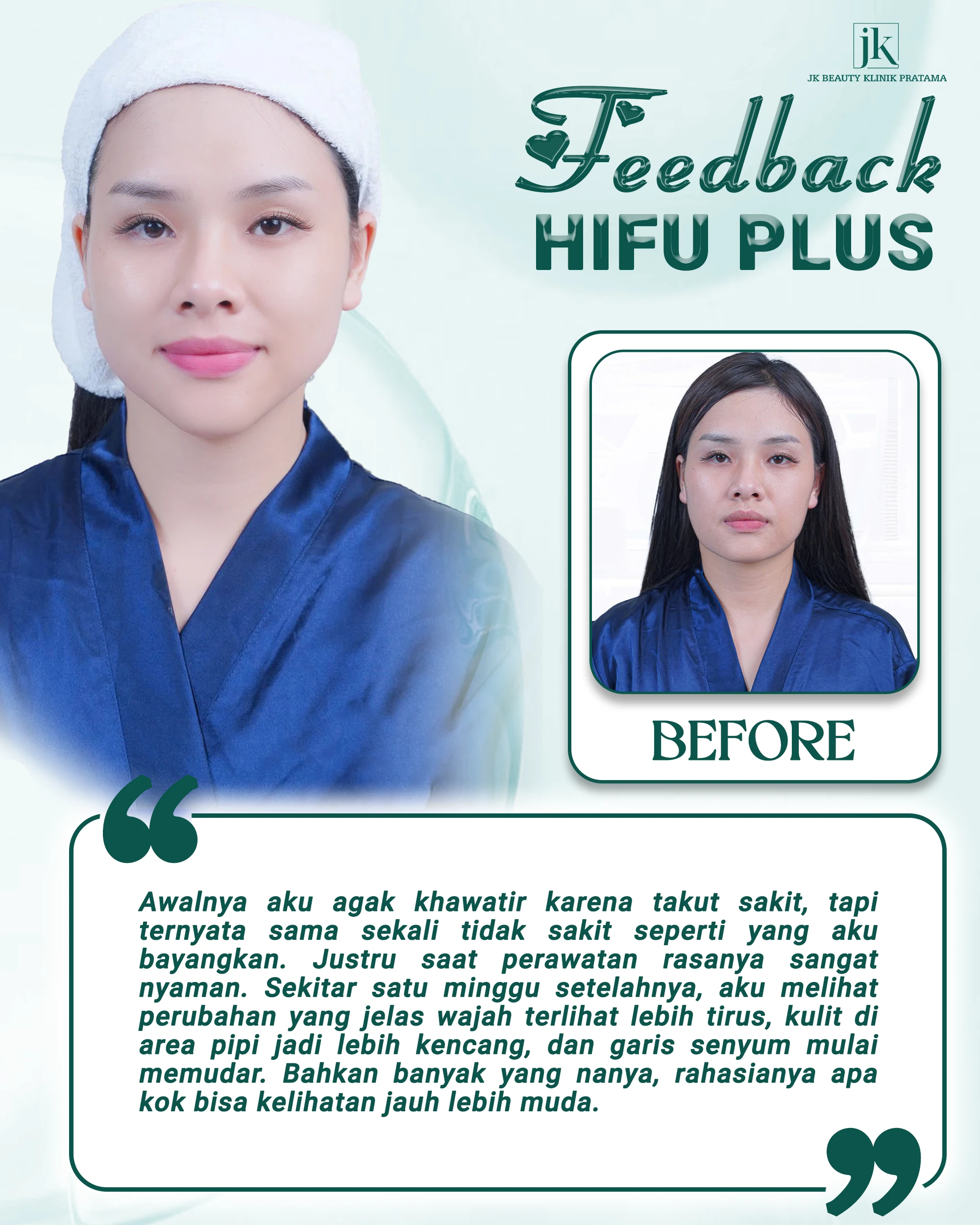 Ulasan HIFU: Apakah benar-benar seefektif yang dirumorkan?