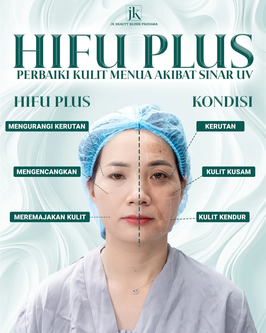 Apakah facelift HIFU lebih baik daripada metode kosmetik non-invasif lainnya?