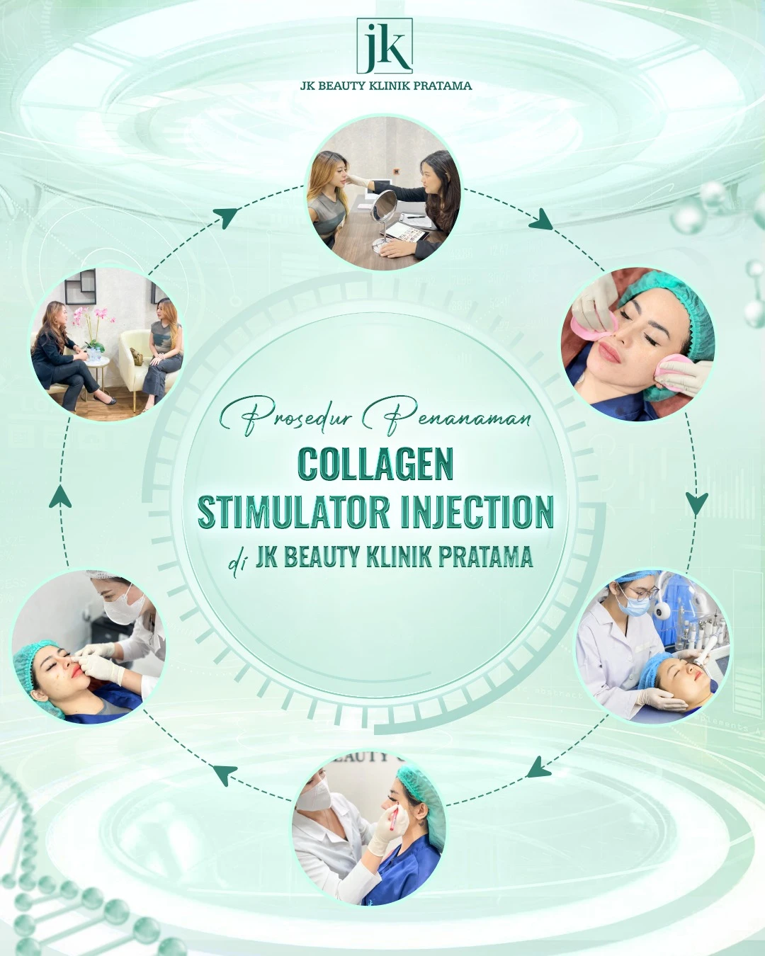 Collagen Stimulator Injection – Langkah Inovatif untuk Peremajaan Alami dengan Efek Ganda di JK